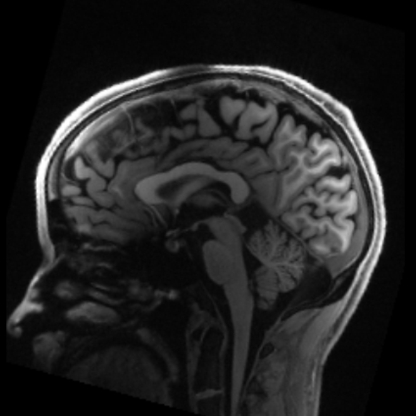 My Brain